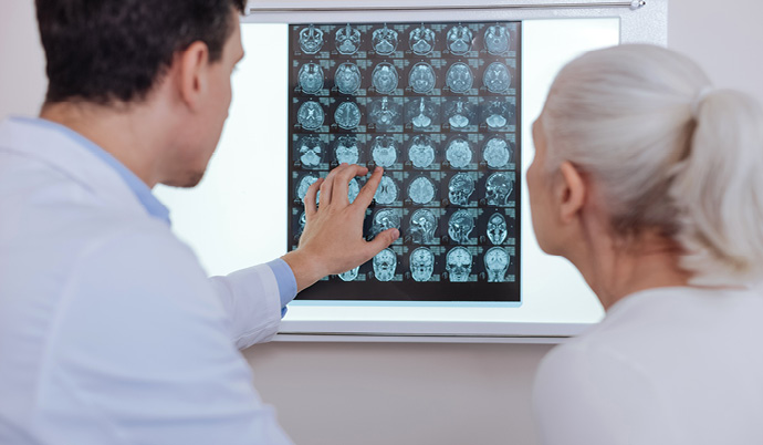 doctors studying brain scans