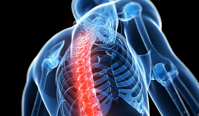spine graphic